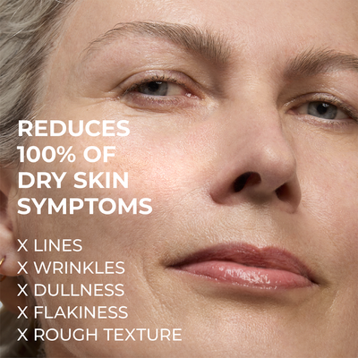 HYDRATION+ MOISTURIZER